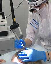 Лазерное лечение шрамов, рубцов (в т.ч. постакне), растяжек